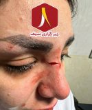 ضرب و شتم پرستار بیمارستان حاجیه نرگس توسط بیمار